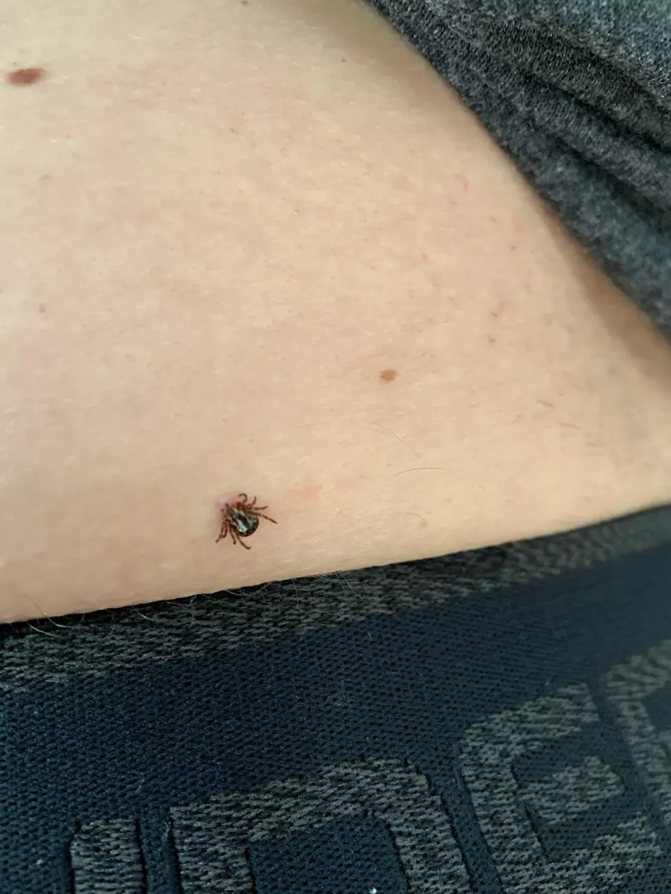 The tick just moments after we found it on my skin!