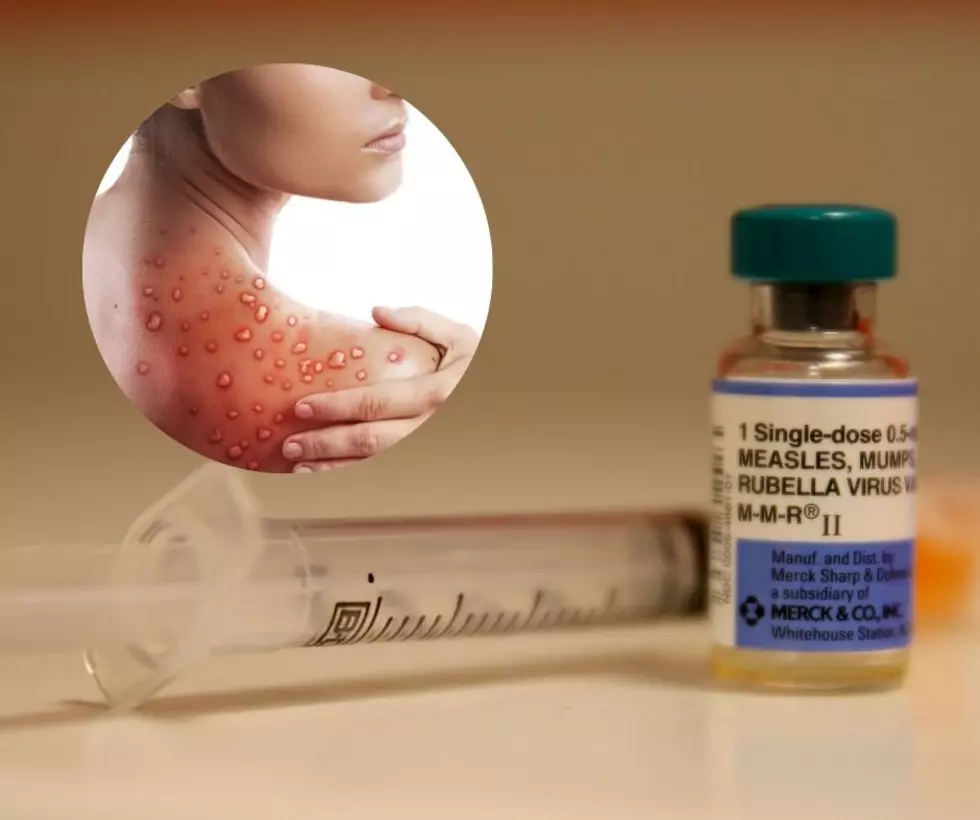 Deadly Measles Outbreak In New York State